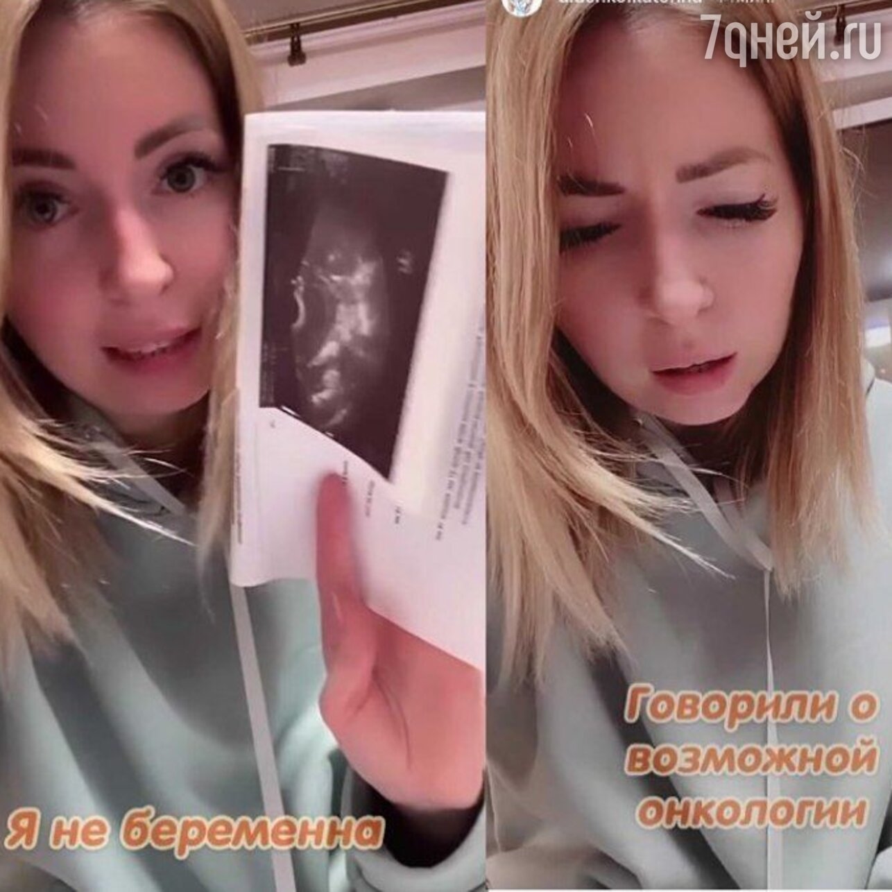 Рак у Екатерины Диденко